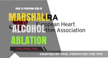 Performing Vein of Marshall Alcohol Ablation: A Step-by-Step Guide
