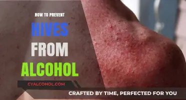 Preventing Alcohol-Induced Hives: Effective Strategies for Relief and Prevention