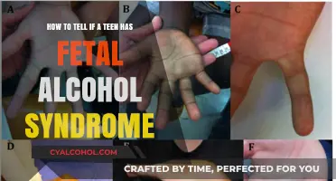 Recognizing Fetal Alcohol Syndrome in Teens