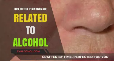 Alcohol-Related Hives: What You Need to Know