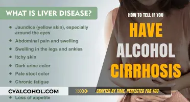 Spotting Alcoholic Cirrhosis: Signs and Symptoms