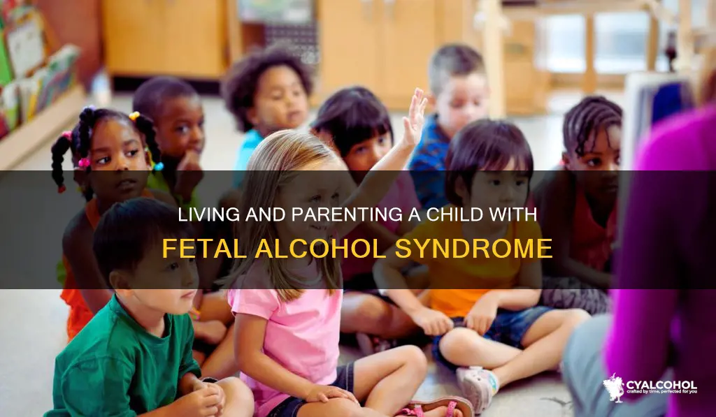 how to work with a child with fetal alcohol syndrome