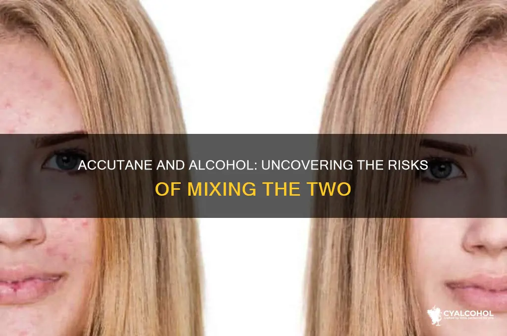 how toxic is accutane and alcohol