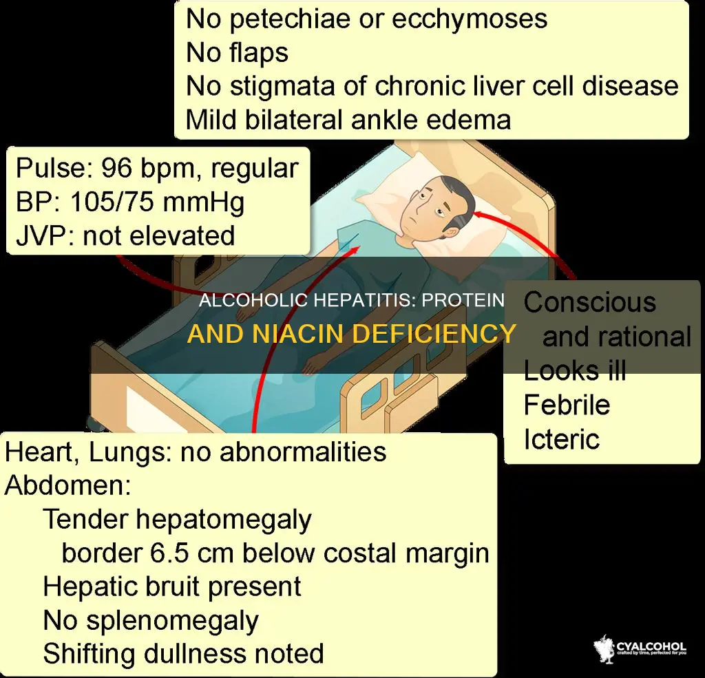 is a deficiency of protein and niacin alcoholic hepatitis
