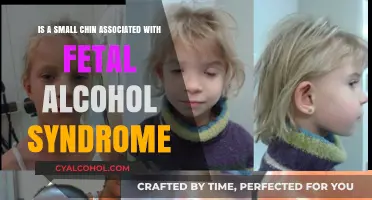Small Chin and Fetal Alcohol Syndrome: Is There a Link?