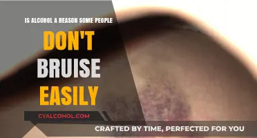 Alcohol and Bruising: Why Some Don't Bruise Easily