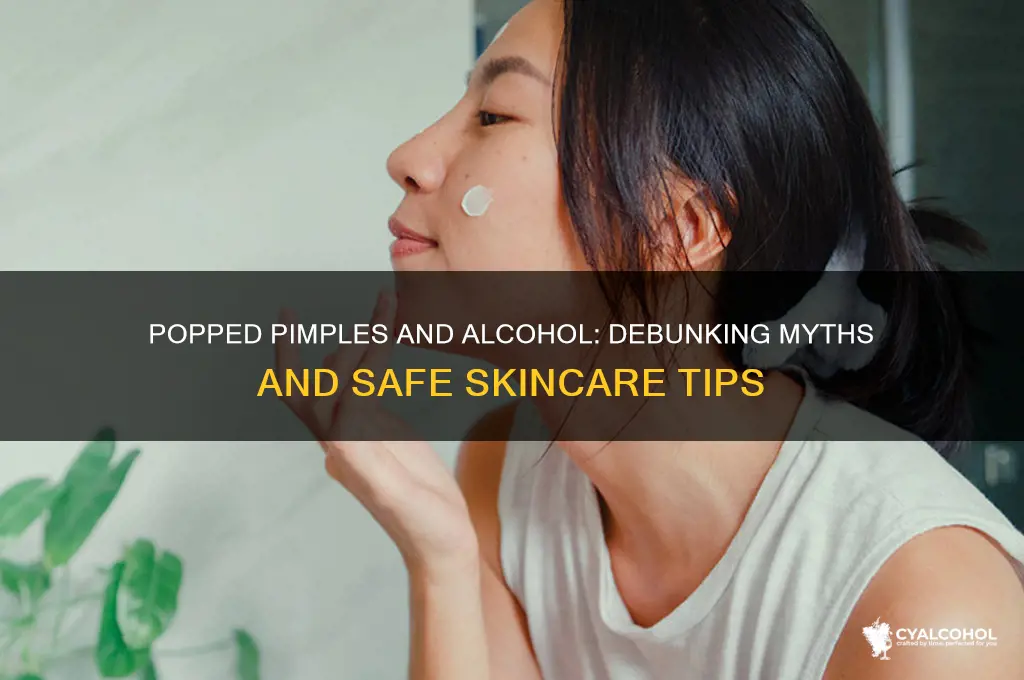 is alcohol in a popped pimples