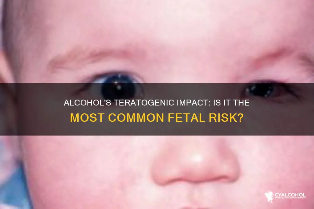 is alcohol the most common teratogen