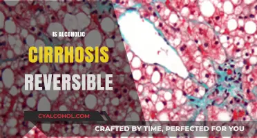Can Alcoholic Cirrhosis Be Reversed? Understanding Liver Health and Recovery