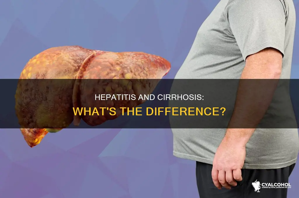 is alcoholic hepatitis and cirrhosis the same thing