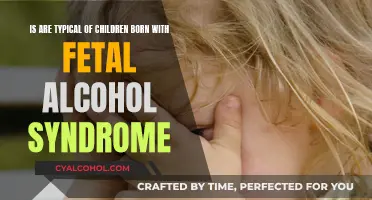 Alcohol's Impact: Children Born with Fetal Alcohol Syndrome