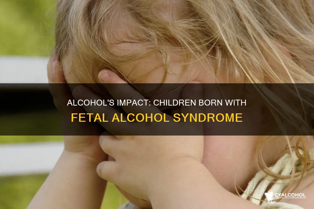 is are typical of children born with fetal alcohol syndrome