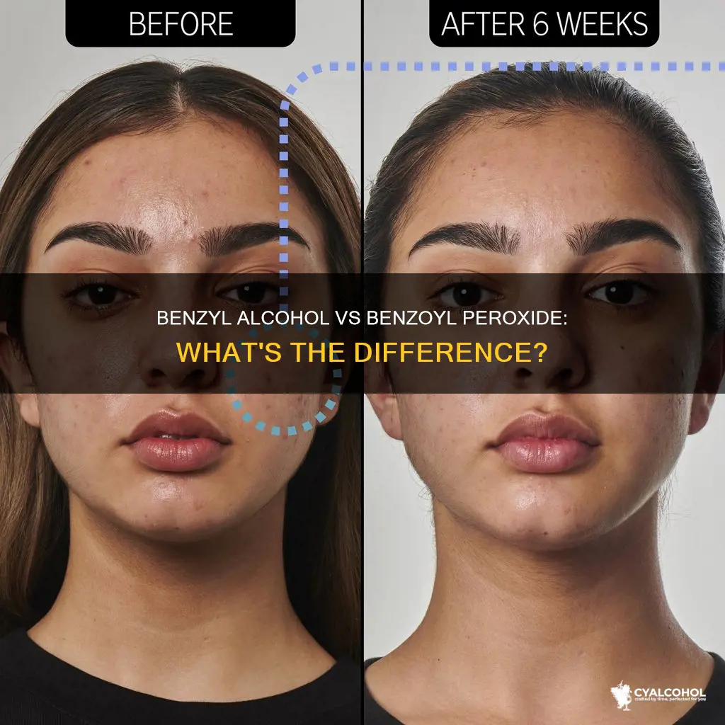 is benzyl alcohol and benzoyl peroxide the same thing