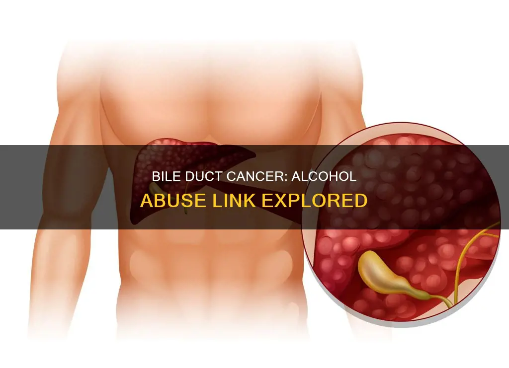 is bile duct cancer a result of alcohol abuse