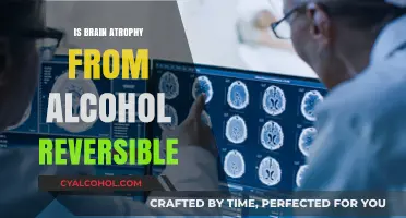 Reversing Alcohol-Induced Brain Atrophy: Hope for Recovery and Healing