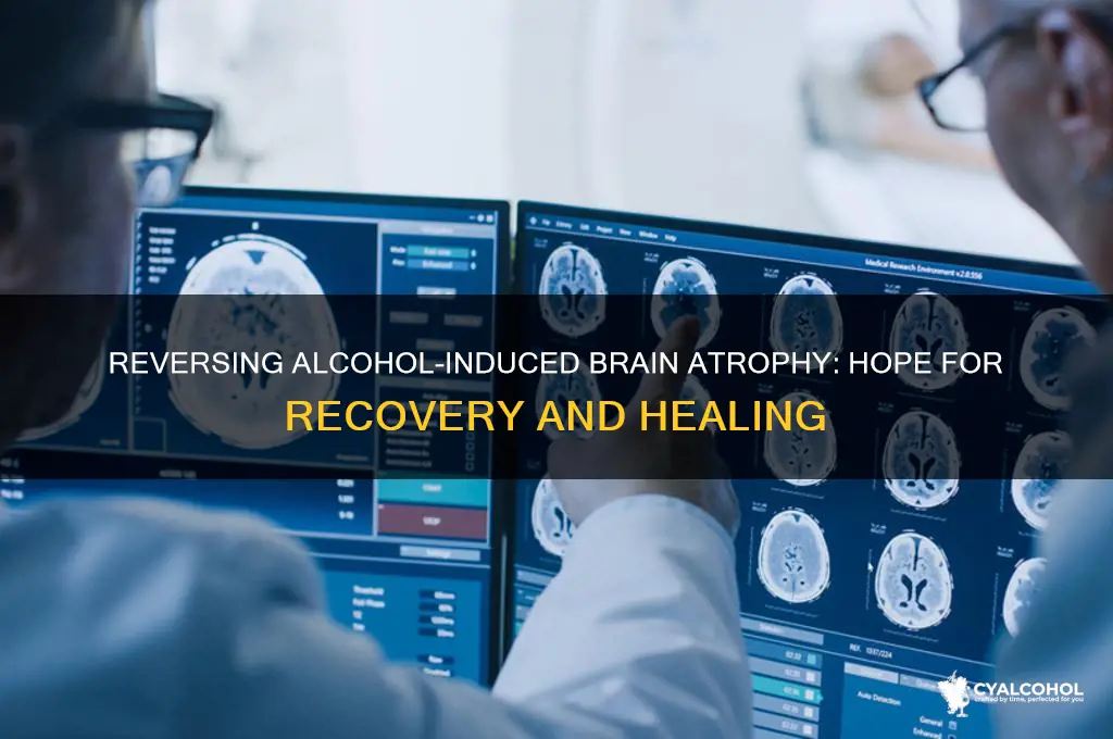 is brain atrophy from alcohol reversible