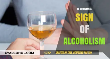 Bruising and Alcoholism: Uncovering the Hidden Link to Excessive Drinking