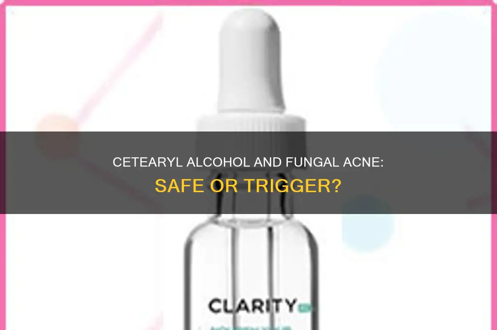 is cetearyl alcohol fungal acne safe