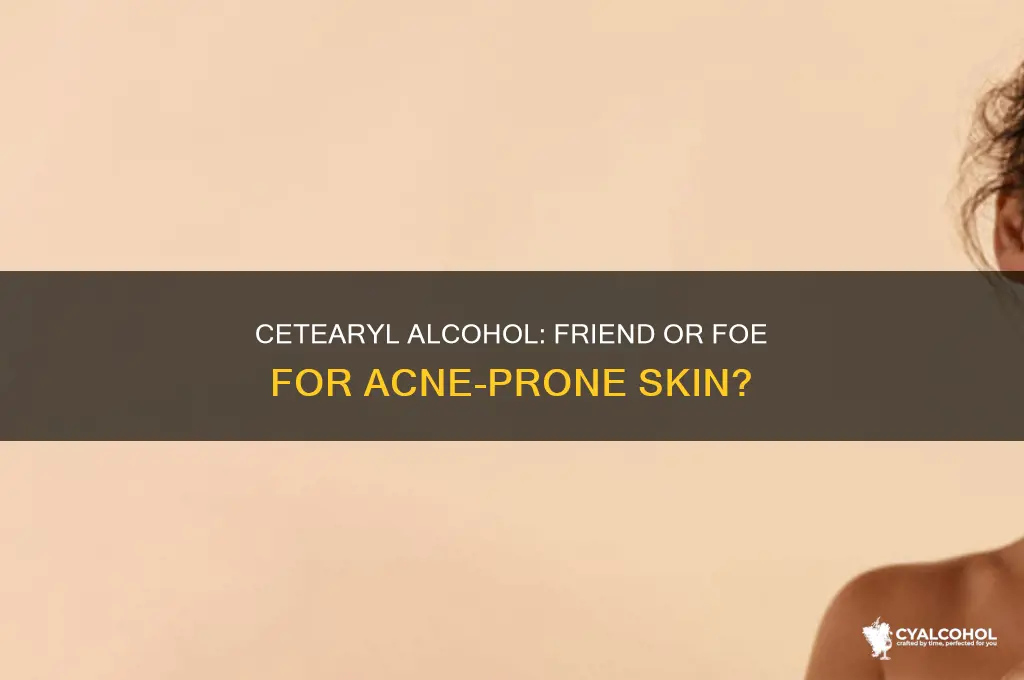 is cetearyl alcohol safe for acne prone skin