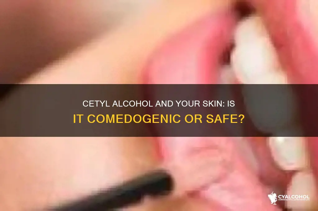 is cetyl alcohol comedogenic