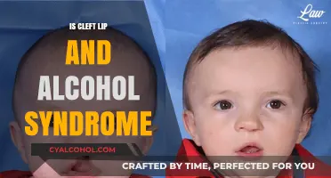 Understanding Cleft Lip and Alcohol Syndrome: Causes, Risks, and Prevention