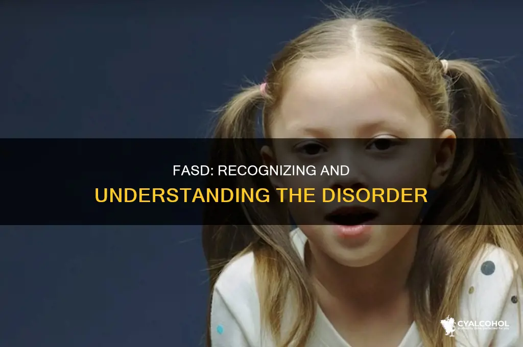 is fetal alcohol spectrum disorder in the dsm
