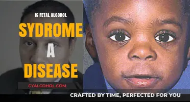 Is Fetal Alcohol Syndrome a Disease? Understanding the Condition