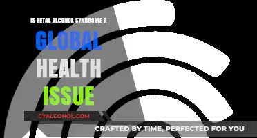 Fetal Alcohol Syndrome: A Global Health Concern?