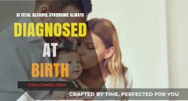 Fetal Alcohol Syndrome: A Missed Diagnosis at Birth?