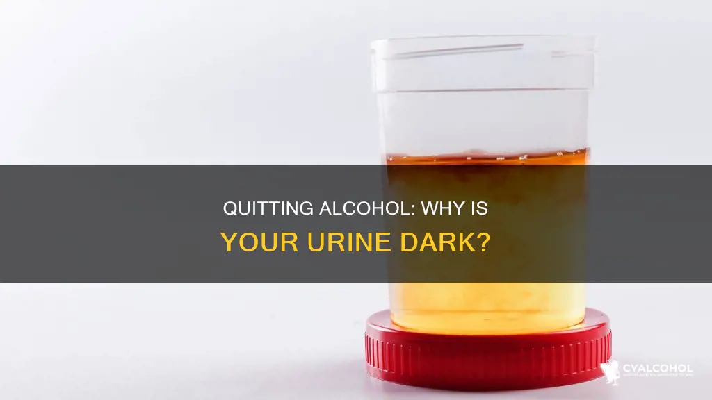 is it normal to have dark urine after quitting alcohol
