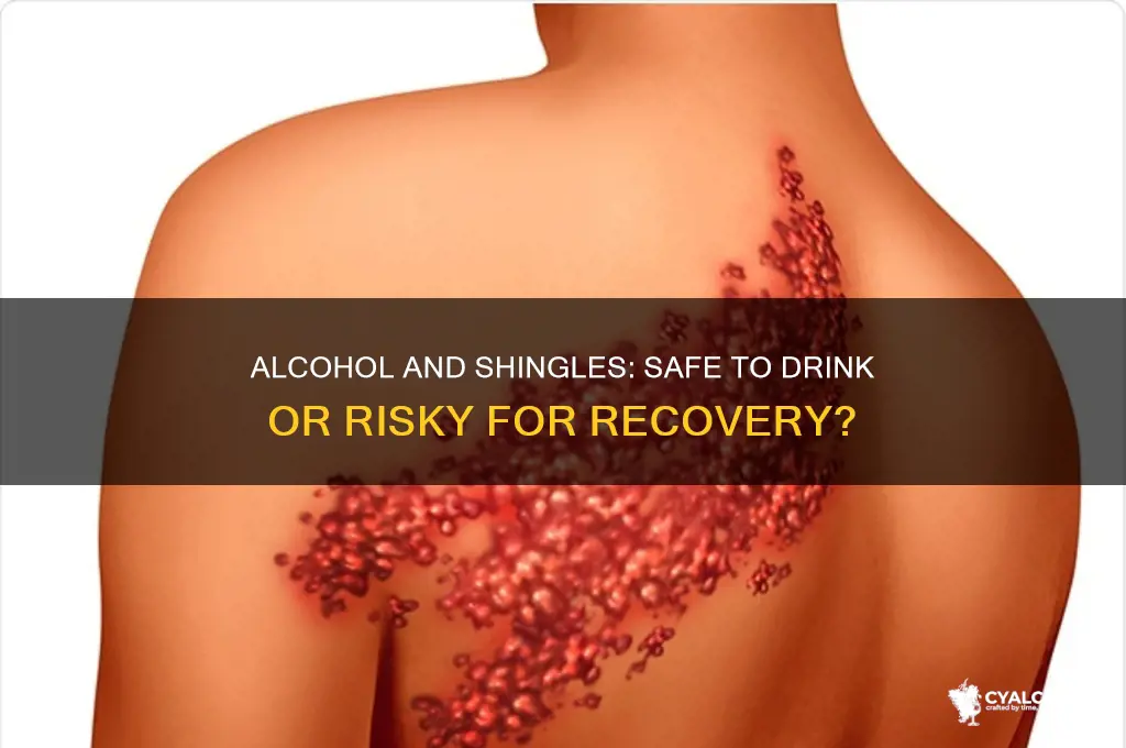 is it ok to consume alcohol with shingles