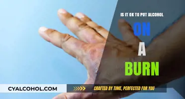Alcohol on Burns: A Safe Practice?
