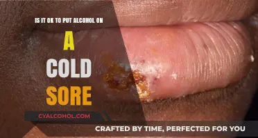 Alcohol and Cold Sores: A Risky Remedy?