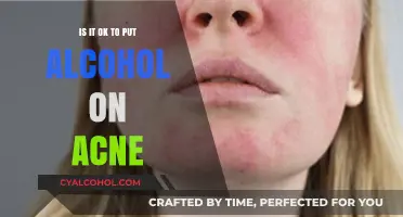 Alcohol on Acne: Safe Solution or Skin Saboteur?