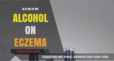 Alcohol and Eczema: Safe Treatment or Skin Irritant?