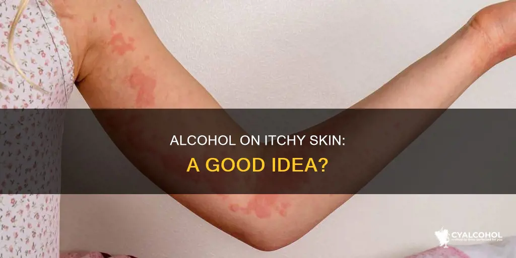 is it ok to wash itchy skin with alcohol