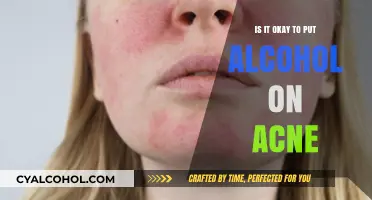 Alcohol on Acne: Safe Solution or Skin Saboteur?