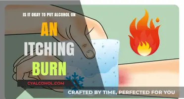 Alcohol on Burns: A Safe Solution for Itching?