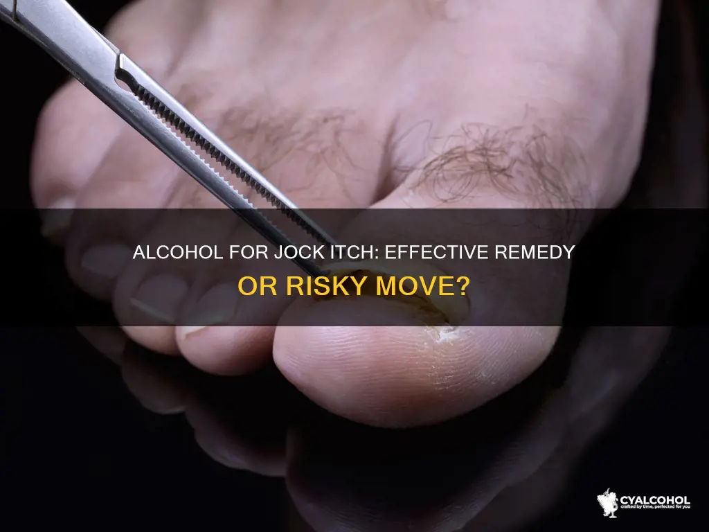 is it okay to put alcohol on jock itch