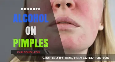 Alcohol on Pimples: Effective Treatment or Skin Care Mistake?