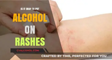 Alcohol on Rashes: Safe Remedy or Skin Irritant?