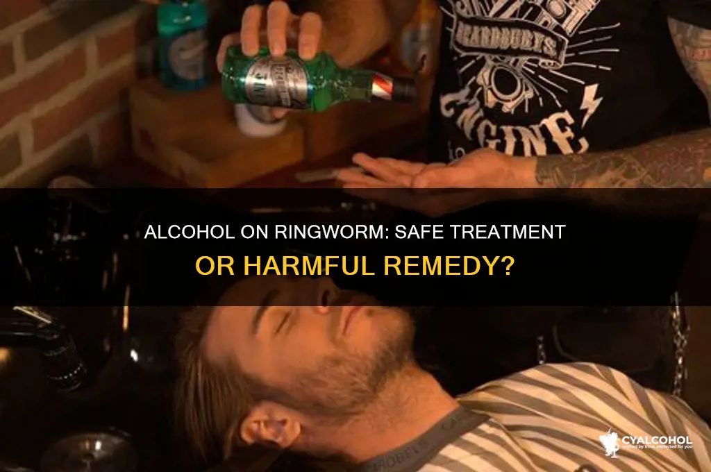 is it okay to put alcohol on ringworm