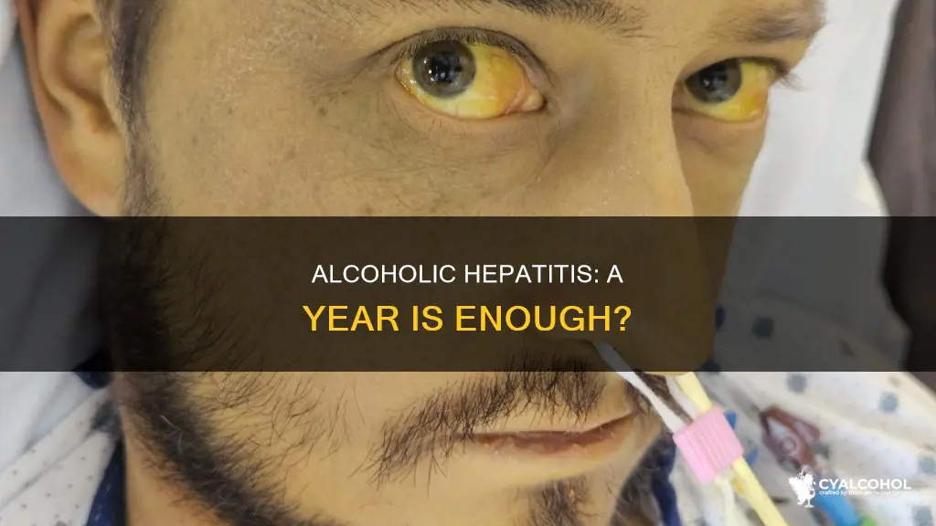 is it possible to develop alcoholic hepatitis in one year
