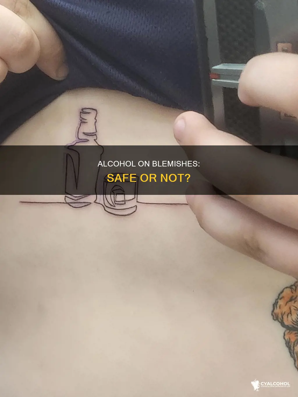 is it safe to put alcohol on blemish wound