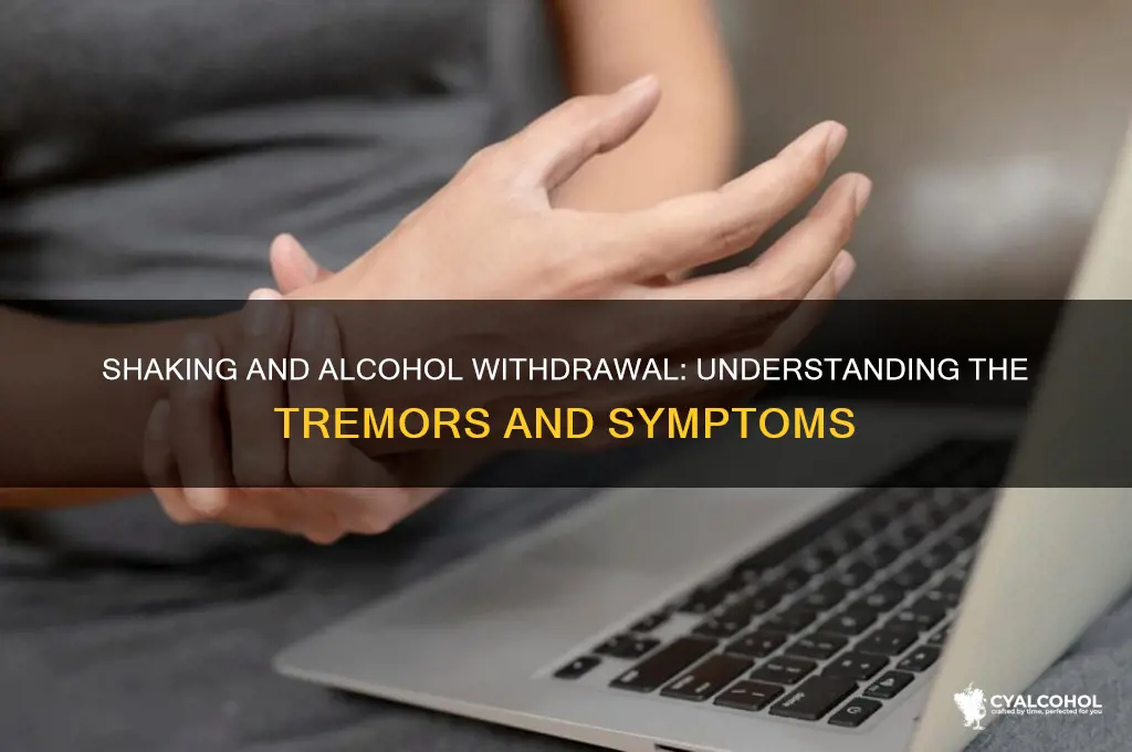 is shaking part of alcohol withdrawal