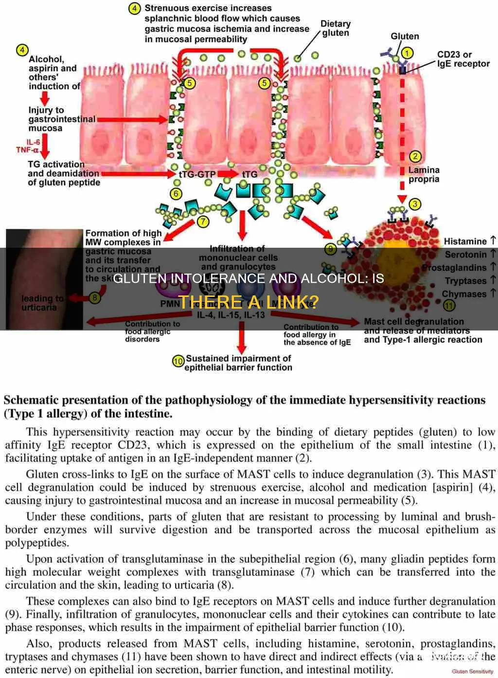 is there a link between gluten intolerance and alcohol