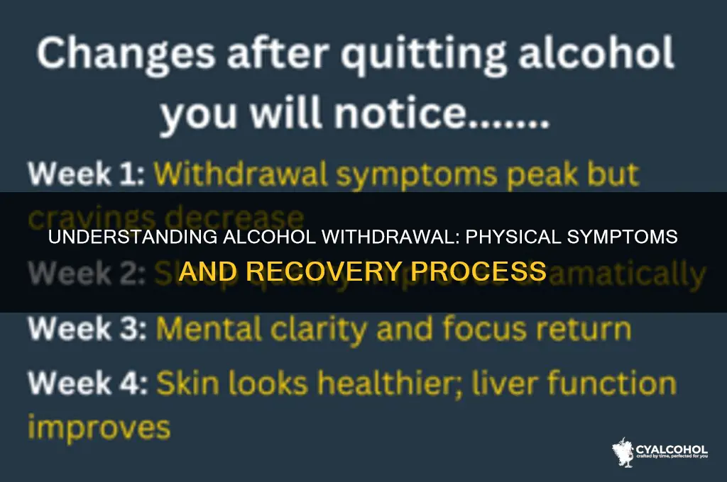 is there physical withdrawal from alcohol