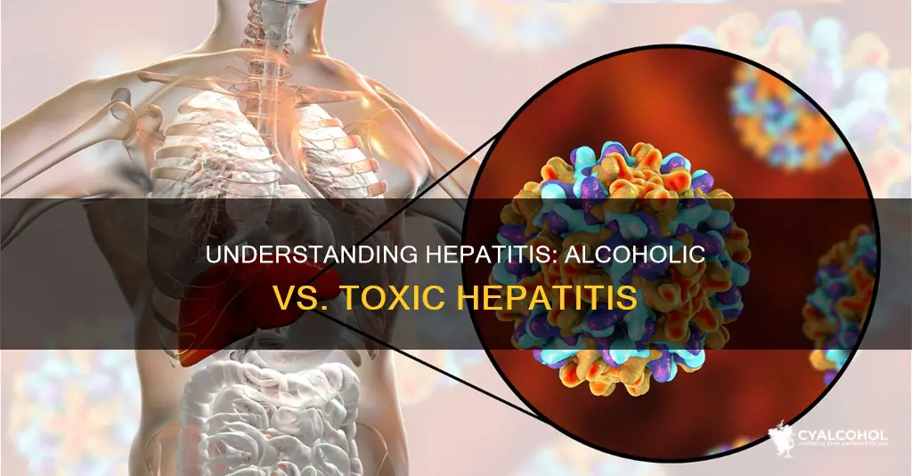 is toxic hepatitis the same as acute alcoholic hepatitis