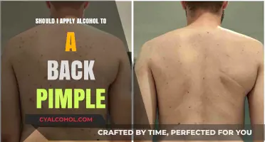 Is Alcohol Safe for Treating Back Pimples? Expert Advice