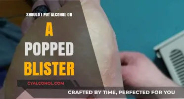 Popped Blister Care: Is Alcohol a Safe Treatment Option?